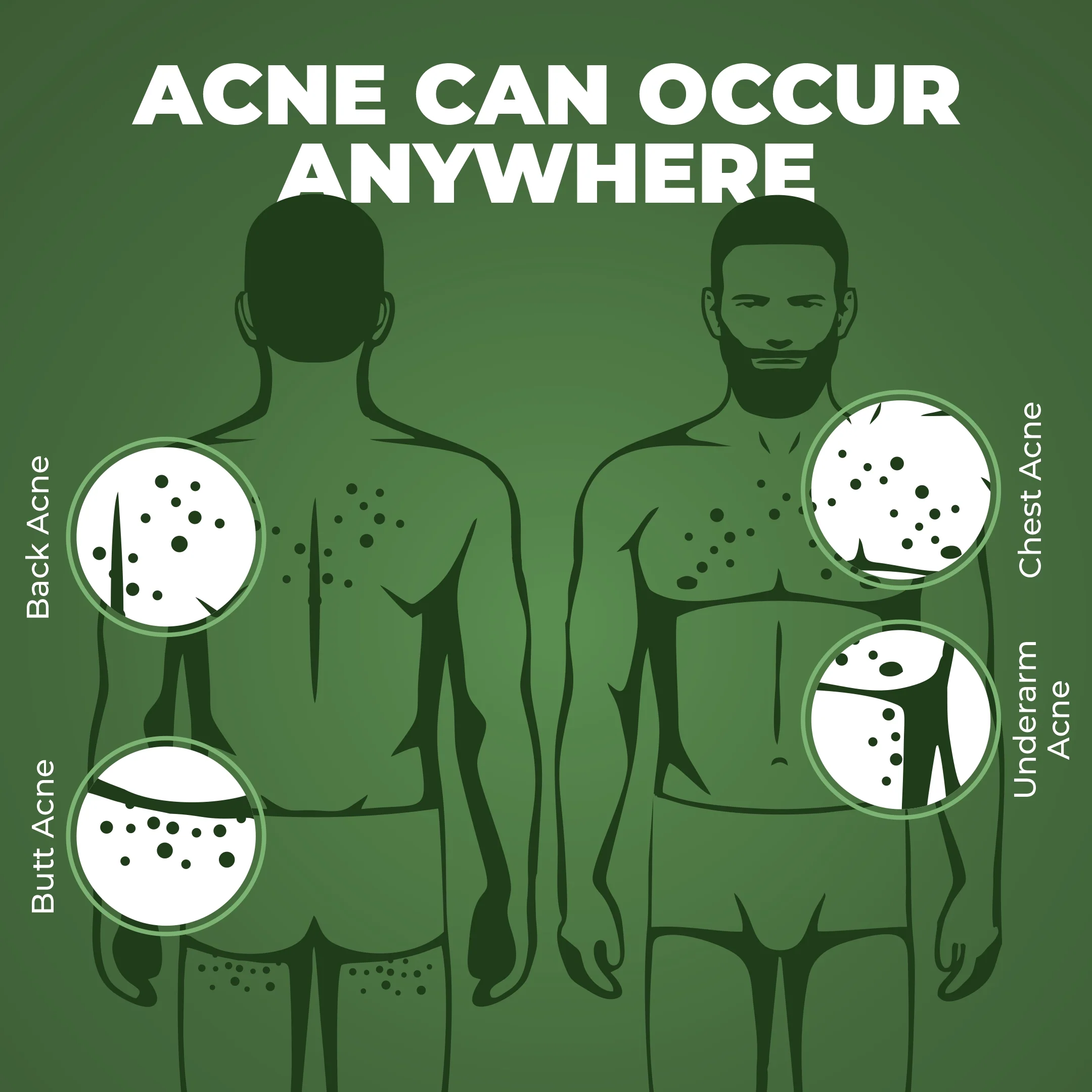 B-Acne Clear Bathing Bar(Pack of 3) - Image 7