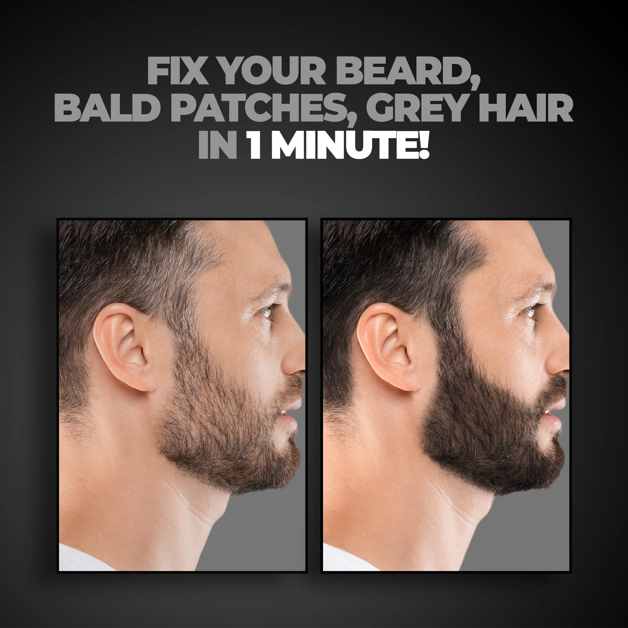 Grey Fix Kit - Image 6